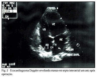 Imagem 2 da galeria