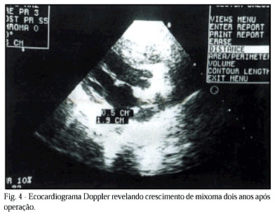 Imagem 4 da galeria