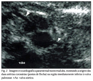 Imagem 2 da galeria