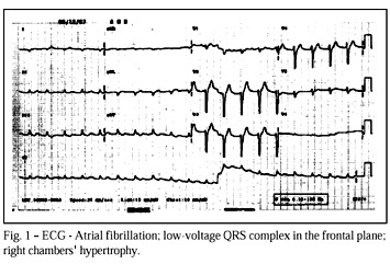 Case report 1/99 - Instituto do Coração do Hospital das Clínicas - FMUSP