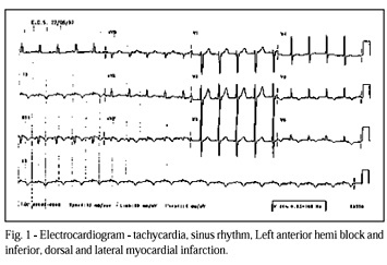 A 40-year-old woman with a pericardial effusion