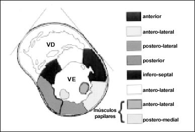Myocardial perfusion by contrast echocardiography. Establishment of normal pattern of intracoronary injection and safety in humans