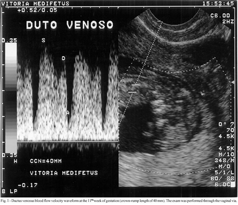 Detection of functional changes of the fetal heart in the first trimester of gestation