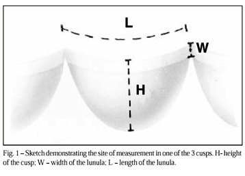 Aortic valve assessment. Anatomical study of 100 healthy human hearts