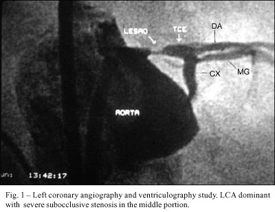 Stenting of unprotected left main coronary artery in a patient with cardiogenic shock