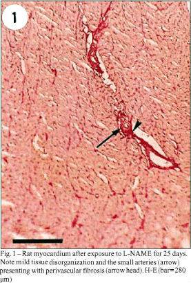 Quantitative study of myocardial microcirculation in arterial hypertension due to progressive inhibition of NO synthesis