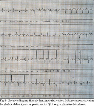 The patient is a 46-year-old female with marked myocardial hypertrophy and heart failure