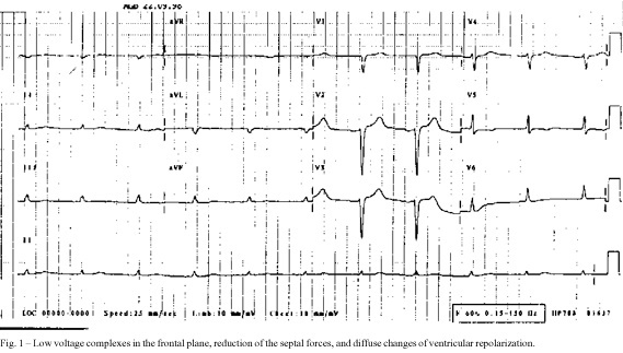 The patient is a 65-year-old woman with heart failure and proteinuria