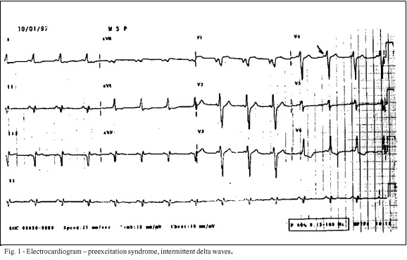 A 15-year-old male with progressive muscular dystrophy of the Becker type and severe heart failure
