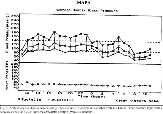Hormonal and cardiovascular reflex assessment in a female patient with pure autonomic failure