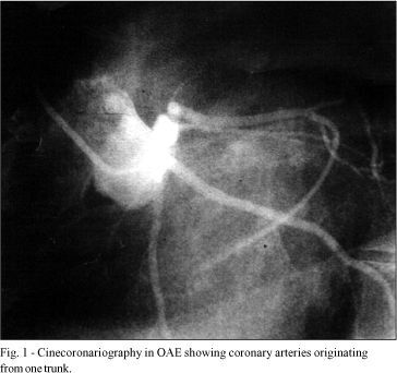 Cantrell Syndrome. Case report of an adult