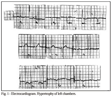 Dyspnea and pain in the left lower limb in a 52-year-old male patient