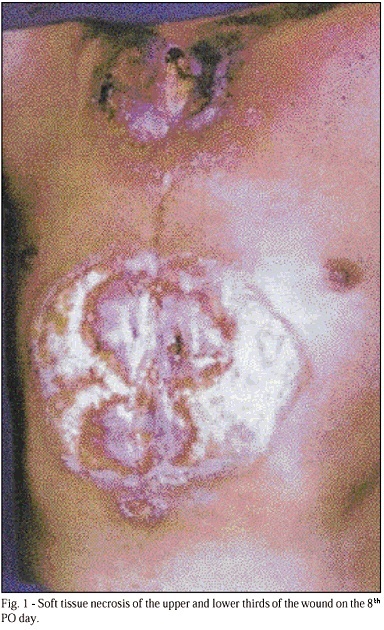 Postoperative necrotizing fasciitis of the thorax in cardiac surgery