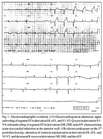 Primary coronary angioplasty in a nonagenarian