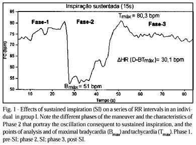 Autonomic Modulation of the Heart in Systemic Arterial Hypertension