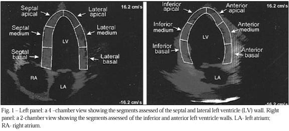 Study of the Myocardial Contraction and Relaxation Velocities through Doppler Tissue Imaging Echocardiography: A New Alternative in the Assessment of the Segmental Ventricular Function
