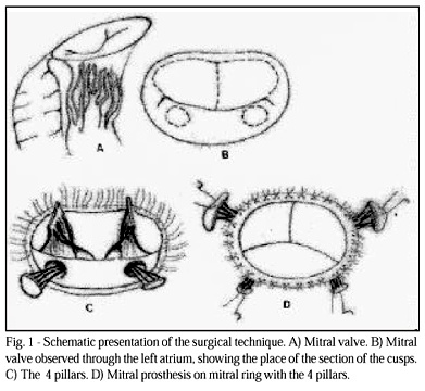 Mitral Valve Replacement and Remodeling of the Left Ventricle in Dilated Cardiomyopathy with Mitral Regurgitation: Initial Results