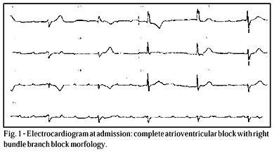 Cardiac Damage from Chronic Use of Chloroquine: A Case Report and Review of the Literature