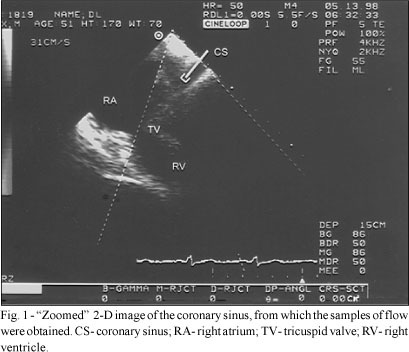 Study of Coronary Sinus Flow Reserve Through Transesophageal Doppler Echocardiography in Normal Subjects