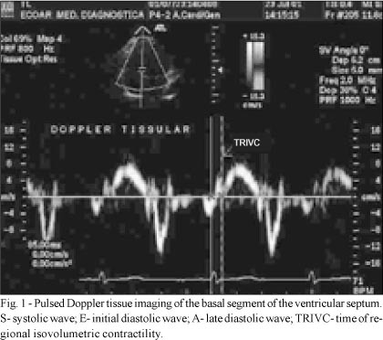 Doppler tissue imaging to assess systolic function in Chagas' disease