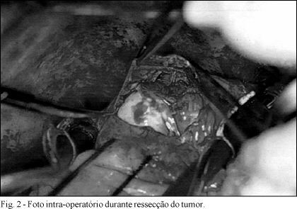Imagem 2 da galeria