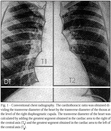 Value of the radiological study of the thorax for diagnosing left ventricular dysfunction in Chagas' disease