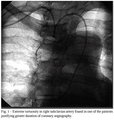 Comparative study of the use of diltiazem as an antispasmodic drug in coronary angiography via the transradial approach