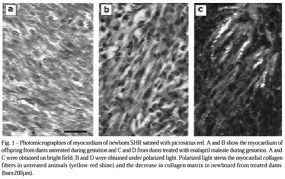Enalapril alters the formation of the collagen matrix in spontaneously hypertensive rats