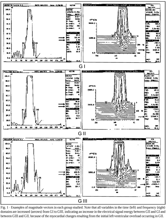 Detection of incipient left ventricular hypertrophy in mild to moderate arterial hypertension with normal electrocardiogram and echocardiogram: a new use for signal-averaged electrocardiography