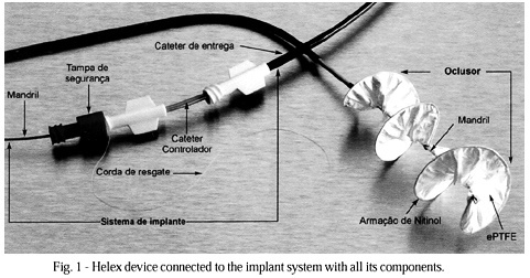 Initial experience in Brazil with the Helex septal occluder for percutaneous occlusion of atrial septal defects