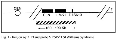 Williams-Beuren syndrome: cardiovascular abnormalities in 20 patients diagnosed with fluorescence in situ hybridization