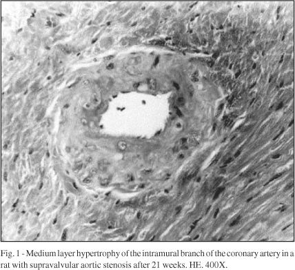 Follow-up study of morphology and cardiac function in rats undergoing induction of supravalvular aortic stenosis