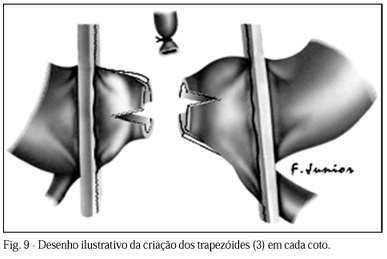 Imagem 8 da galeria