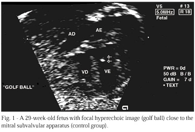 Prenatal study of fetal endocardial hyperrefringence and its relation to maternal toxoplasmosis