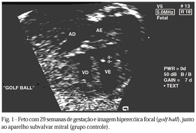 Estudo pré-natal da hiper-refringência endocárdica fetal e sua relação com toxoplasmose materna