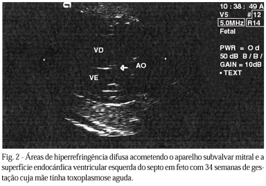 Imagem 2 da galeria