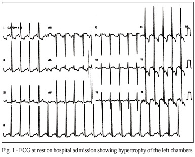 Percutaneous balloon aortic valvuloplasty in a pregnant adolescent