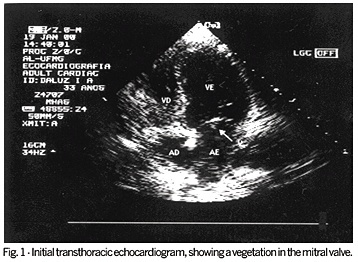 Libman-Sacks endocarditis and oral anticoagulation