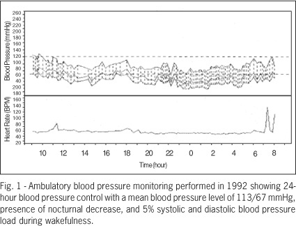 Conn's adenoma: a cause of hypertension and hypokalemia