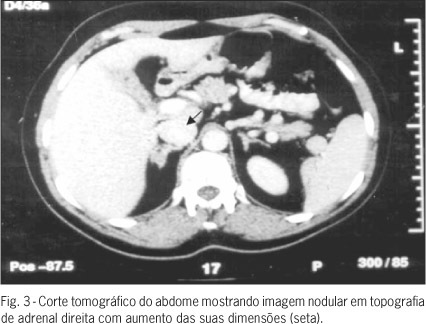 Imagem 3 da galeria
