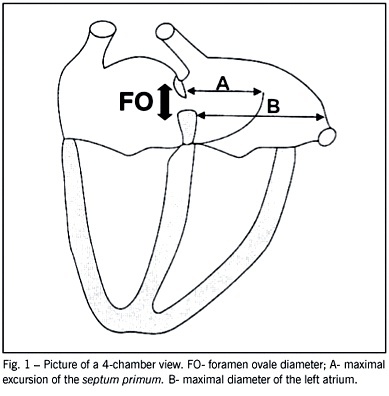 Mobility of the Septum primum does not depend on the foramen ovale diameter in normal fetuses