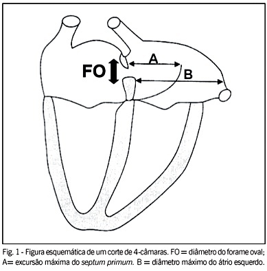 A mobilidade do Septum primum não depende do diâmetro do forame oval em fetos normais