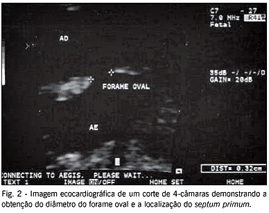 Imagem 2 da galeria