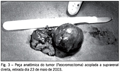 Imagem 3 da galeria