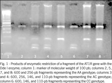 The A1166C polymorphism of the angiotensin II type-1 receptor in acute myocardial infarction