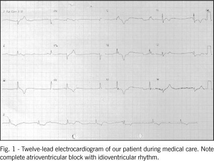 Syncope and complete atrioventricular block related to pulmonary thromboembolism