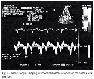 Changes in the parameters of left ventricular diastolic function according to age on tissue Doppler imaging