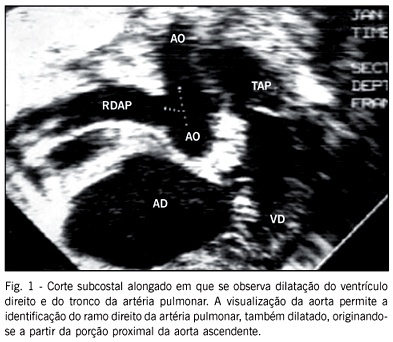 Imagem 1 da galeria