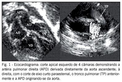 Imagem 1 da galeria