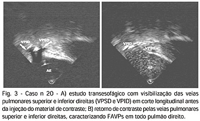 Imagem 3 da galeria
